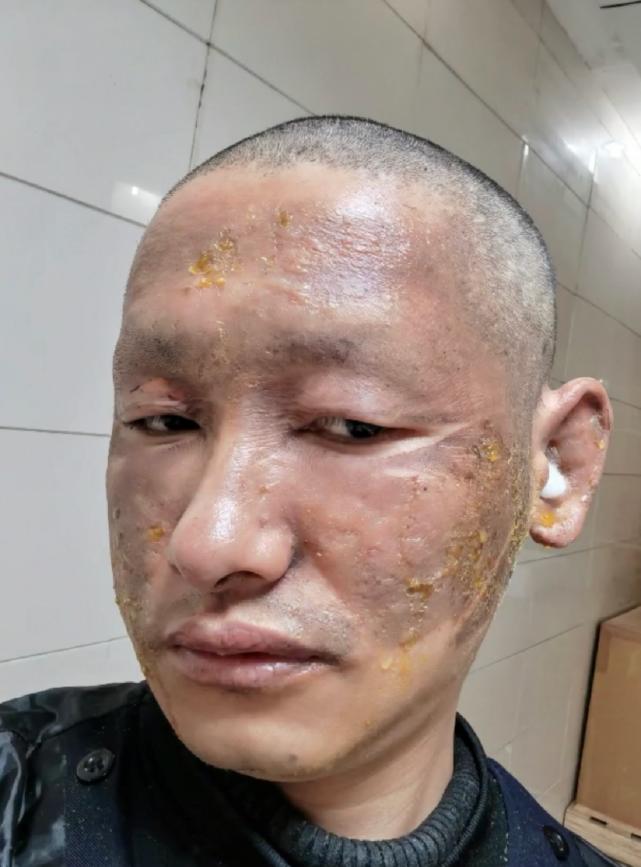 探索星光的奧秘，明星天臉重塑魅力的奇跡之旅