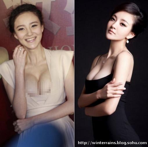 明星隆胸背后的審美趨勢(shì)與個(gè)人立場(chǎng)探討