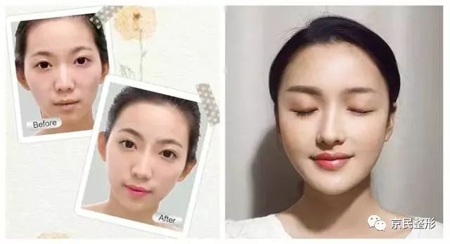 最新眉部美容技術(shù)，塑造完美眉型，瞬間驚艷全場(chǎng)的美顏秘訣 ???