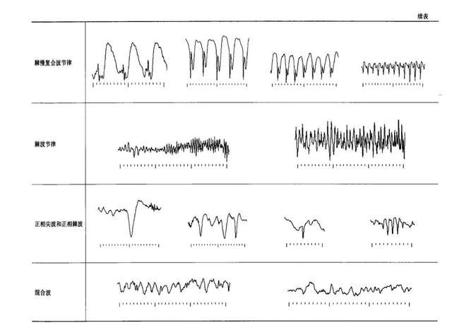視頻腦電圖之旅，愛(ài)與陪伴的溫馨故事探尋價(jià)格揭秘
