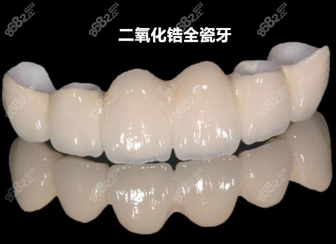 二氧化鋁全瓷牙價格變動與追求自信成就感的關聯(lián)探索