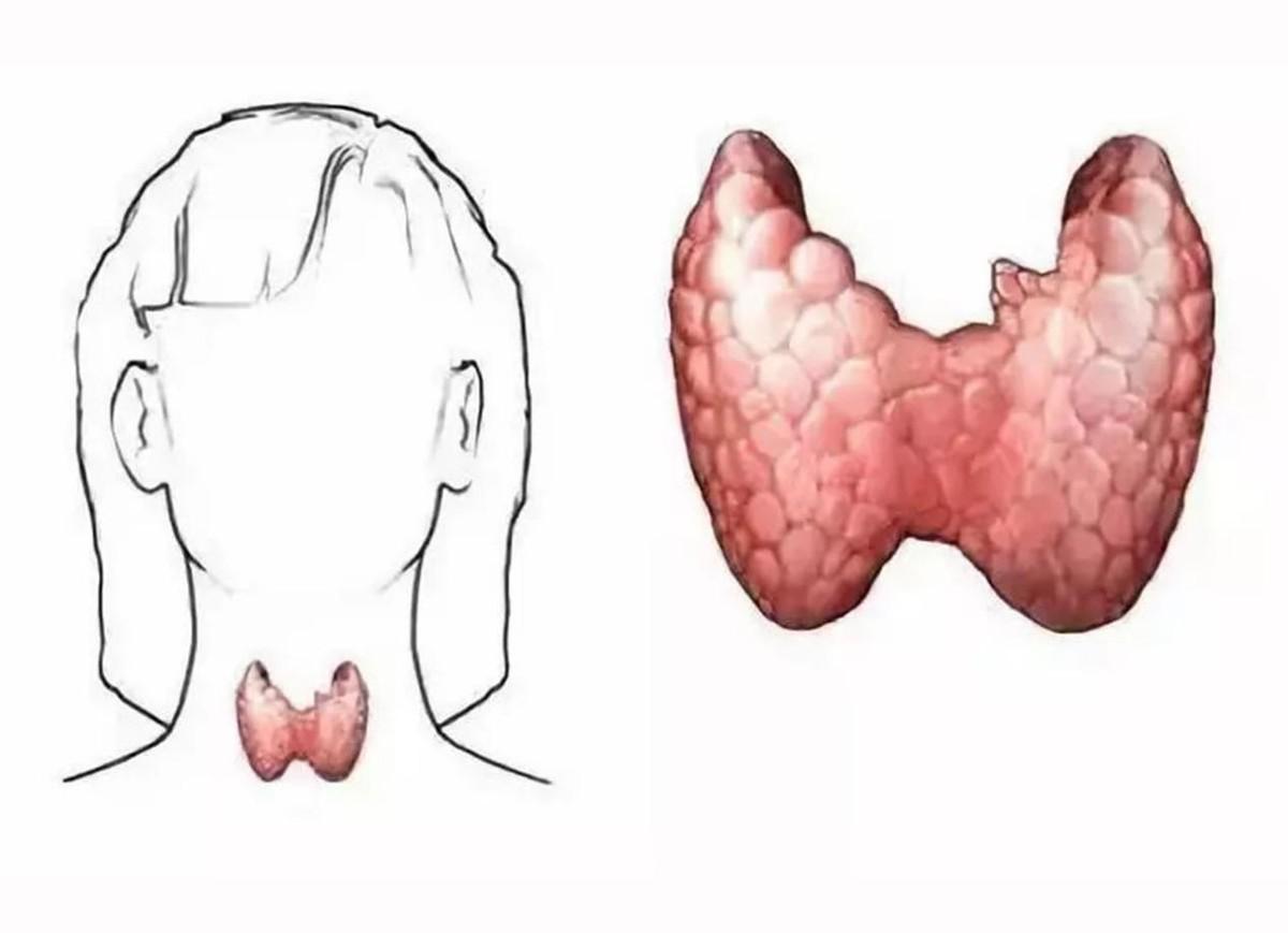 最新甲狀腺檢查步驟指南，詳細(xì)步驟解析