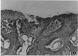 最新沷尼松研究與應(yīng)用進展的探討