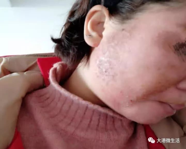 最新寶顏術，探索美容新境界的奧秘